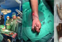 Holy Family Hospital Rawalpindi where doctors reattached a child’s severed hand