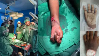 Holy Family Hospital Rawalpindi where doctors reattached a child’s severed hand